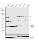 SOCS2 Antibody in Western Blot (WB)
