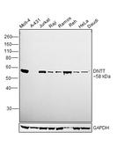TdT Antibody in Western Blot (WB)
