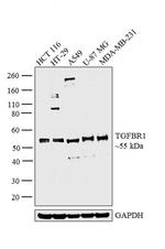 TGFBR1 Antibody in Western Blot (WB)