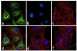 Rat IgG (H+L) Secondary Antibody in Immunocytochemistry (ICC/IF)