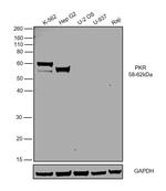 PKLR Polyclonal Antibody