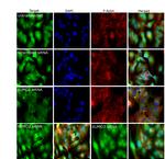 SUMO1 Antibody in Immunocytochemistry (ICC/IF)