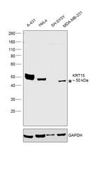 Cytokeratin 15 Antibody