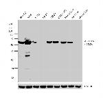 ALDH1A1 Antibody in Western Blot (WB)