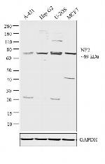 NF2 Antibody in Western Blot (WB)