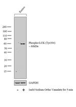 Phospho-LCK (Tyr394) Polyclonal Antibody