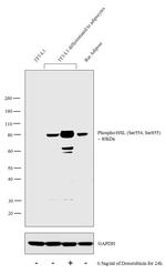 Phospho-HSL (Ser554, Ser855) Antibody in Western Blot (WB)