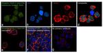 Phospho-HDAC5 (Ser259) Antibody in Immunocytochemistry (ICC/IF)