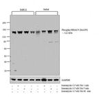 Phospho-HDAC5 (Ser259) Antibody in Western Blot (WB)