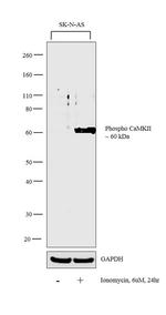 Phospho-CaMKII alpha/beta/delta (Thr305) Antibody in Western Blot (WB)