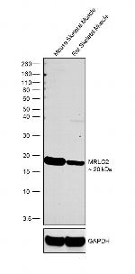 MRLC2 Antibody in Western Blot (WB)