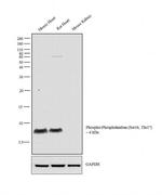 Phospho-Phospholamban (Ser16, Thr17) Antibody