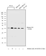Histone 1F0 Antibody in Western Blot (WB)