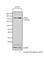 LATS2 Antibody
