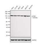 LATS2 Antibody in Western Blot (WB)