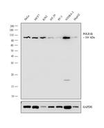 POLR1B Antibody in Western Blot (WB)