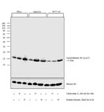 H3K27ac Antibody in Western Blot (WB)