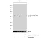 Phospho-CHK1 (Ser317) Antibody in Western Blot (WB)