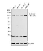 SLC12A3 Polyclonal Antibody