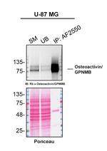 GPNMB Antibody in Immunoprecipitation (IP)