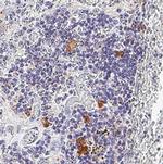 TNF alpha Antibody in Immunohistochemistry (Paraffin) (IHC (P))