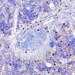 NKp46 Antibody in Immunohistochemistry (Paraffin) (IHC (P))