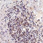 SOX10 Antibody in Immunohistochemistry (Paraffin) (IHC (P))