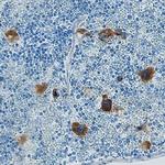 CXCL2 Antibody in Immunohistochemistry (Paraffin) (IHC (P))
