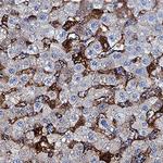 ST2 Polyclonal Antibody