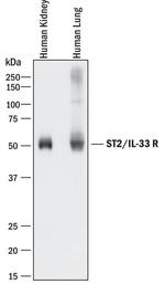 ST2 Antibody in Western Blot (WB)