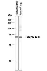 ST2 Antibody in Western Blot (WB)