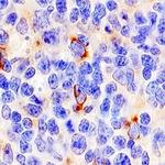 CD137 Antibody in Immunohistochemistry (Paraffin) (IHC (P))