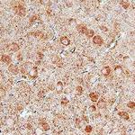UNC5B Polyclonal Antibody