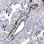 IL1RAPL2 Polyclonal Antibody