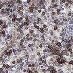 IL17RB Polyclonal Antibody
