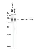 CD51 Antibody in Western Blot (WB)