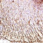 NOTCH3 Antibody in Immunohistochemistry (Paraffin) (IHC (P))
