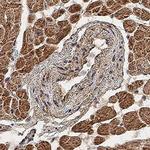 IL13RA1 Polyclonal Antibody