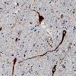 CARTPT Polyclonal Antibody