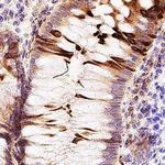 Carbonic Anhydrase IV Polyclonal Antibody