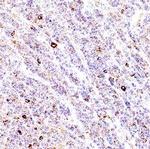 CD223 Antibody in Immunohistochemistry (Paraffin) (IHC (P))