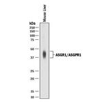 ASGR1 Polyclonal Antibody