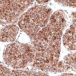 CRHBP Polyclonal Antibody