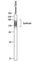 LUM Antibody in Western Blot (WB)