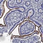 MEP1B Polyclonal Antibody