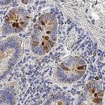 Kallikrein 12 Polyclonal Antibody