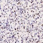 SOX21 Antibody in Immunohistochemistry (Paraffin) (IHC (P))