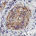 MIP-3 alpha Antibody in Immunohistochemistry (Paraffin) (IHC (P))