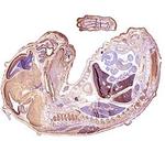 SLIT3 Polyclonal Antibody