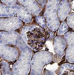 Thrombomodulin Polyclonal Antibody